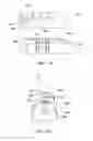 Fig. 09 - Method and system for fixing removable dentures