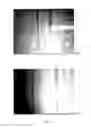 Fig. 06 - MICRO-DEVICE AND METHOD FOR SELECTIVE AND NON-INVASIVE SEPARATION AND EXTRACTION OF PARTICLES IN POLYDISPERSED SUSPENSIONS, MANUFACTURING PROCESS AND APPLICATIONS THEREOF