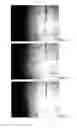 Fig. 08 - MICRO-DEVICE AND METHOD FOR SELECTIVE AND NON-INVASIVE SEPARATION AND EXTRACTION OF PARTICLES IN POLYDISPERSED SUSPENSIONS, MANUFACTURING PROCESS AND APPLICATIONS THEREOF