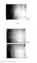 Fig. 09 - MICRO-DEVICE AND METHOD FOR SELECTIVE AND NON-INVASIVE SEPARATION AND EXTRACTION OF PARTICLES IN POLYDISPERSED SUSPENSIONS, MANUFACTURING PROCESS AND APPLICATIONS THEREOF