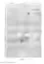 Fig. 04 - Detection of hepatitis C virus RNA