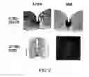 Fig. 03 - Methods of selecting a dopaminergic neuron proliferative progenitor cells using Lrp4/Corin markers