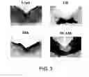 Fig. 04 - Methods of selecting a dopaminergic neuron proliferative progenitor cells using Lrp4/Corin markers