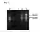 Fig. 02 - Method of detecting colon cancer marker