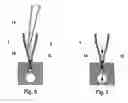 Fig. 04 - Immunoassay assembly and methods of use