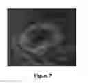 Fig. 08 - CLASSIFYING AMYLOIDOSIS