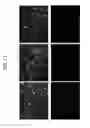 Fig. 14 - Live-cell signals of pathogen intrusion and methods thereof