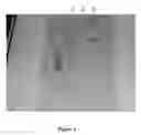 Fig. 04 - Purification and concentration of proteins and DNA from a complex sample using isotachophoresis and a device to perform the purification