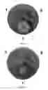 Fig. 02 - Alcohol-based skin cleanser