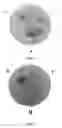 Fig. 03 - Alcohol-based skin cleanser