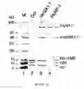 Fig. 23 - PARP inhibitors
