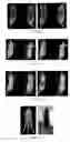 Fig. 07 - PSMA binding ligand-linker conjugates and methods for using