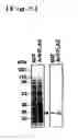 Fig. 06 - PHAGE-DISPLAYING SINGLE-CHAIN ANTIBODY CAPABLE OF RECOGNIZING NON-REDUCED MANNOSE RESIDUE