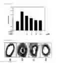 Fig. 02 - NOVEL USE OF DIMETHYLFUMARATE