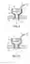 Fig. 06 - DEVICE AND METHOD FOR IMPROVING HEARING