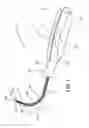 Fig. 06 - Insertion device and method for delivery of a mesh carrier