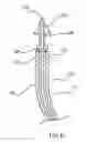 Fig. 07 - Insertion device and method for delivery of a mesh carrier