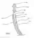 Fig. 09 - Insertion device and method for delivery of a mesh carrier