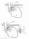 Fig. 07 - Apparatus for treating GERD
