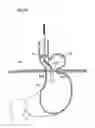 Fig. 22 - Apparatus for treating GERD