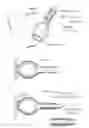 Fig. 35 - Apparatus for treating GERD