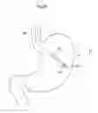 Fig. 09 - Apparatus for treating obesity