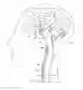 Fig. 01 - Methods and apparatuses for navigating the subarachnoid space