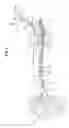Fig. 02 - Methods and apparatuses for navigating the subarachnoid space