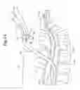 Fig. 03 - Methods and apparatuses for navigating the subarachnoid space