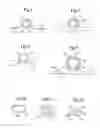 Fig. 06 - Methods and apparatuses for navigating the subarachnoid space