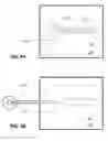 Fig. 07 - Methods and devices for remote ischemic preconditioning and near-continuous blood pressure monitoring