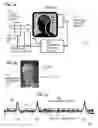 Fig. 02 - REAL TIME STIMULUS TRIGGERED BY BRAIN STATE TO ENHANCE PERCEPTION AND COGNITION