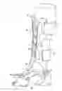 Fig. 01 - Adjustable splinting device