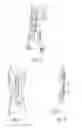 Fig. 05 - Adjustable splinting device