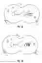 Fig. 06 - Dosage control electrode for iontophoresis device