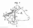 Fig. 02 - Implant pellets and method using same