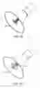 Fig. 31 - Aortic Valve Repair