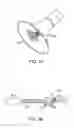 Fig. 33 - Aortic Valve Repair
