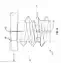Fig. 07 - Method and apparatus for securing an object to bone and/or for stabilizing bone