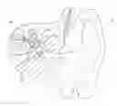 Fig. 01 - Middle ear reconstruction process and apparatus for performing the process