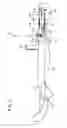 Fig. 03 - Medical instrument