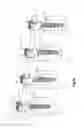 Fig. 02 - Revision connector for spinal constructs