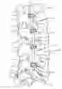 Fig. 01 - Methods and Devices for Treating a Multi-Level Spinal Deformity