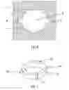 Fig. 04 - Device for osteosynthesis