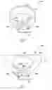 Fig. 06 - Method and apparatus for optimizing vagal nerve stimulation using laryngeal activity