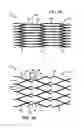 Fig. 02 - Locked segments pushable stent-graft