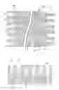 Fig. 07 - Intravascular stents