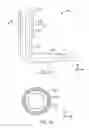 Fig. 08 - Catheter-based annuloplasty using ventricularly positioned catheter