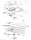 Fig. 02 - Intraocular lens system and method for power adjustment