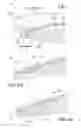 Fig. 06 - Intraocular lens system and method for power adjustment